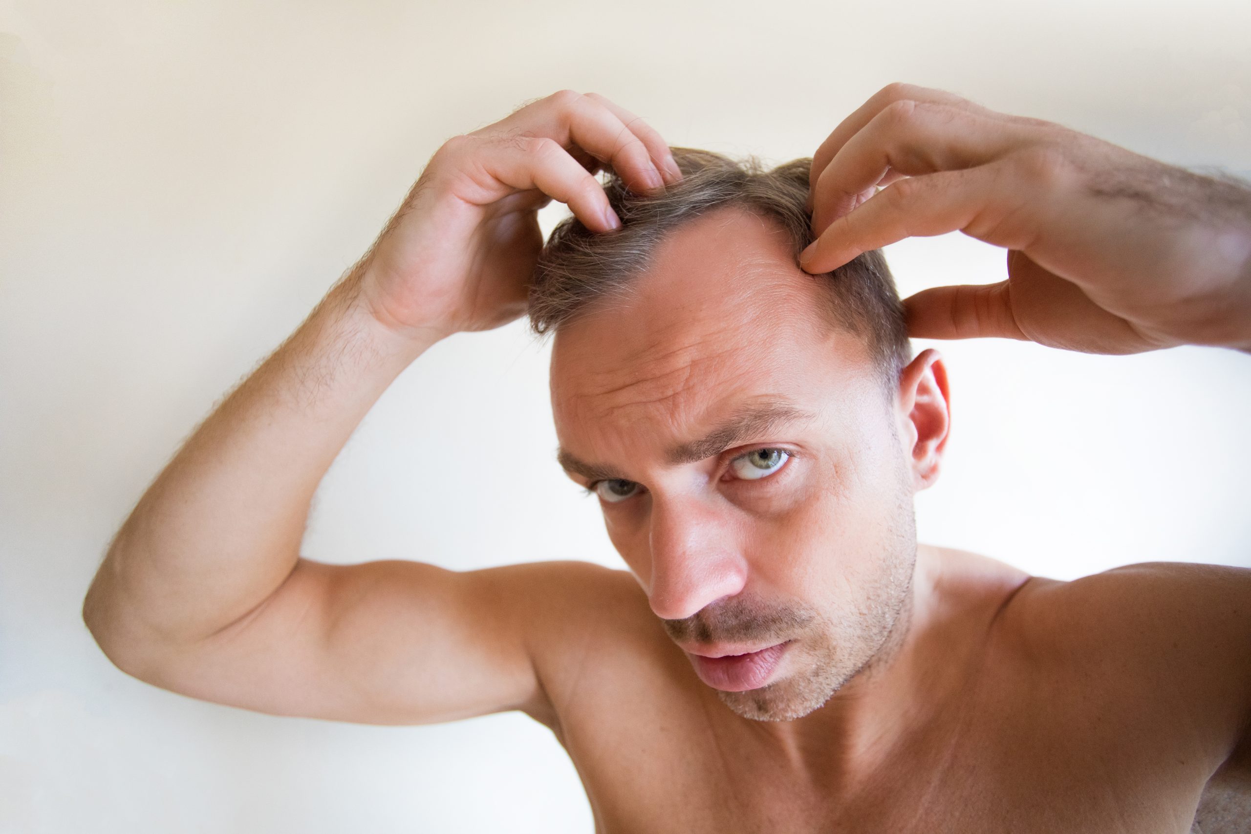 DHI Direct Hair Implant in Abu Dhabi
