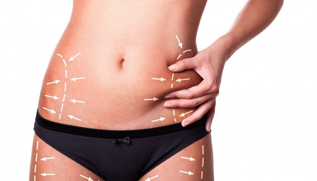 Liposuction Abu Dhabi