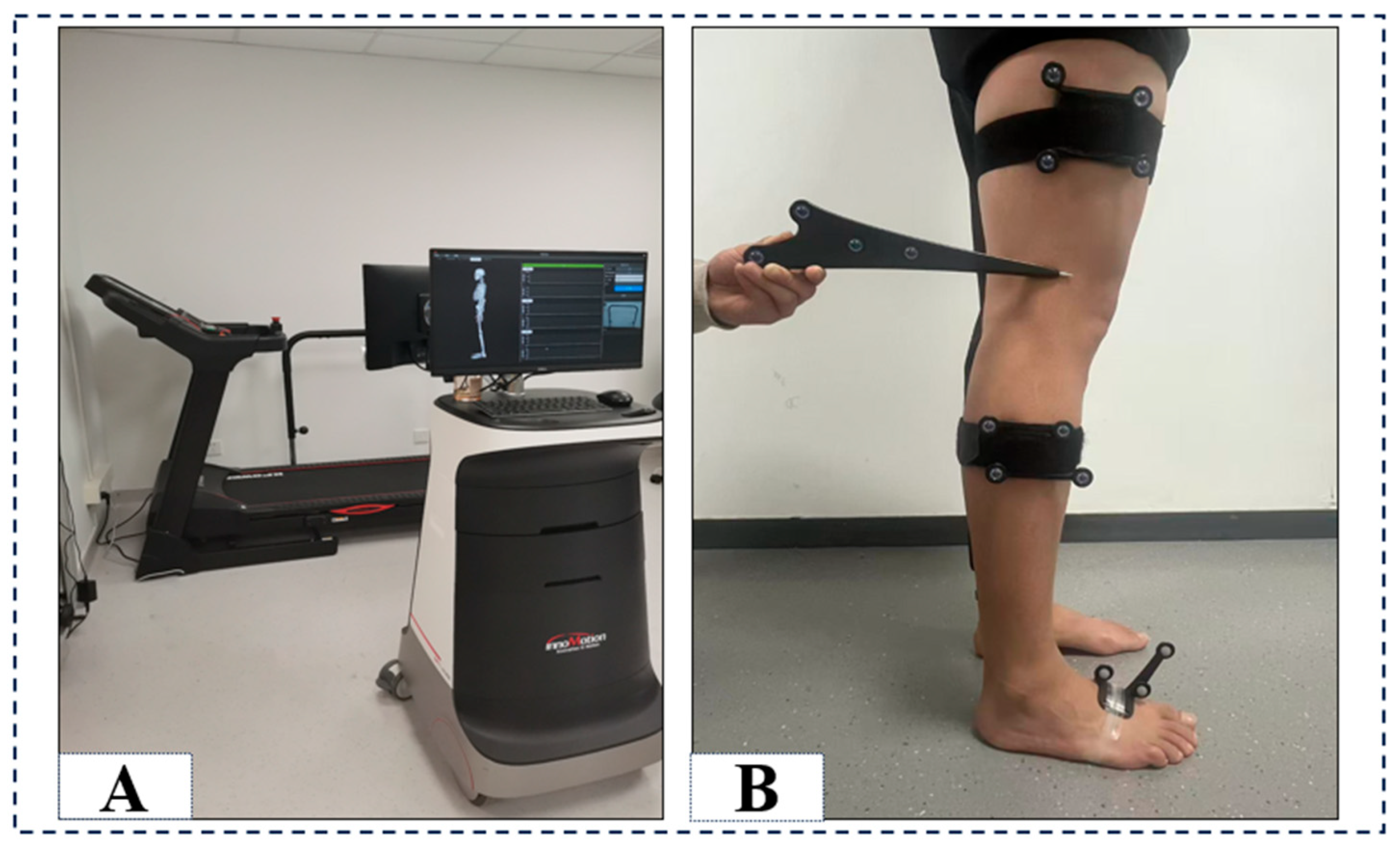 Smart Tech Gait Analysis | 2026 Innovations in Podiatry
