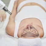 Can Laser Carbon Peel Help Tired Looking Skin