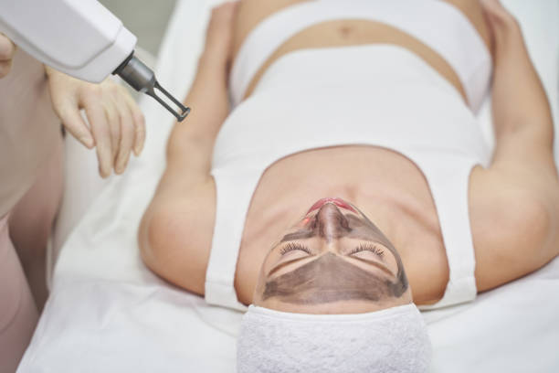 Can Laser Carbon Peel Help Tired Looking Skin