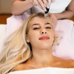Can Microneedling Reduce Post Acne Skin Damage