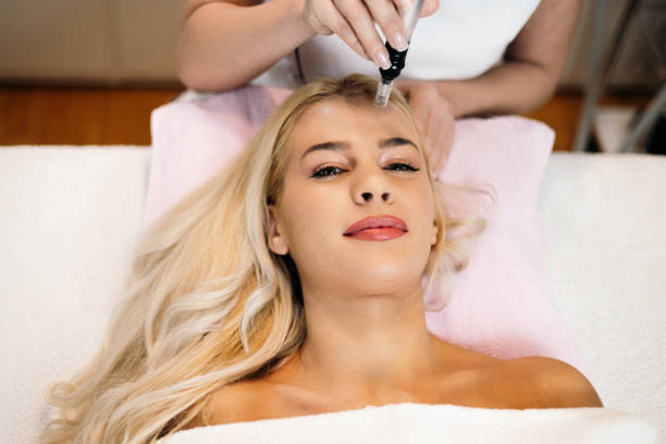 Can Microneedling Reduce Post Acne Skin Damage