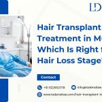 pcos hair loss and transplant in trivandrum