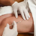 Smooth Legs Start Here with Expert Sclerotherapy Treatments