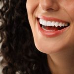 Teeth Whitening in Riyadh